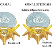 Strength-to-your-spine2